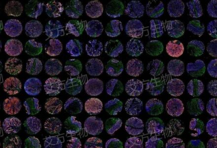 突破!艾方生物实现组织芯片16标17色超多指标共染!_组织芯片网