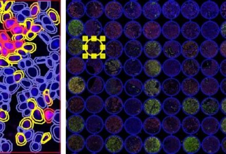 组织芯片定制+多重荧光免疫组化实验+AI病理高阶分析,上海威奥生物一站式解决_组织芯片网